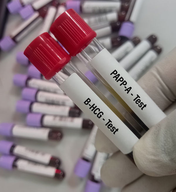 Test PAPP-A jako część badania prenatalnego w Gdańsku