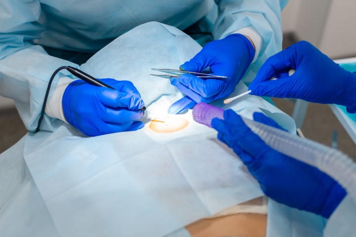 Diagnostyka i leczenie zmian skórnych – zdjęcie poglądowe