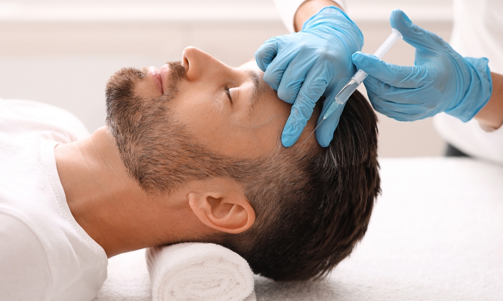 Peptide scalp mesotherapy for selected hair concerns