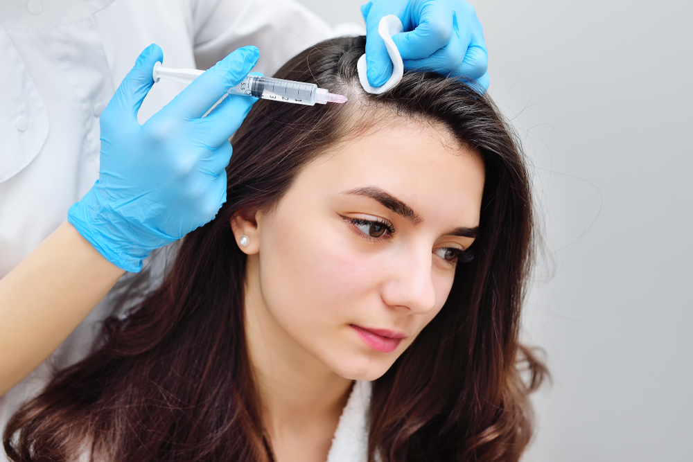 Peptide scalp mesotherapy for selected hair concerns