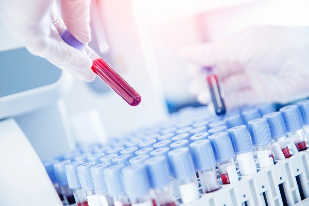 laboratorium gdańsk - badania krwi, genetyczne